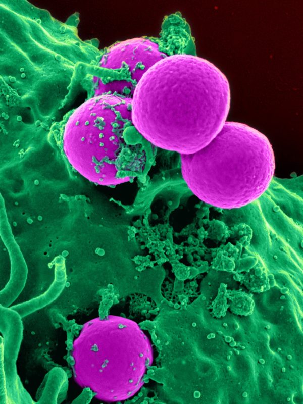 white-blood-cell-cell-blood-cell-blood-45239.jpeg white-blood-cell-cell-blood-cell-blood-45239.jpeg